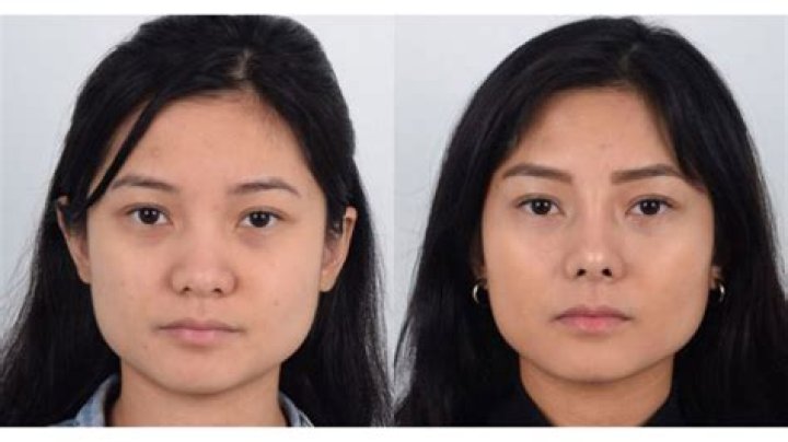 Unveiling Jisoo's Transformation: Before And After Rhinoplasty